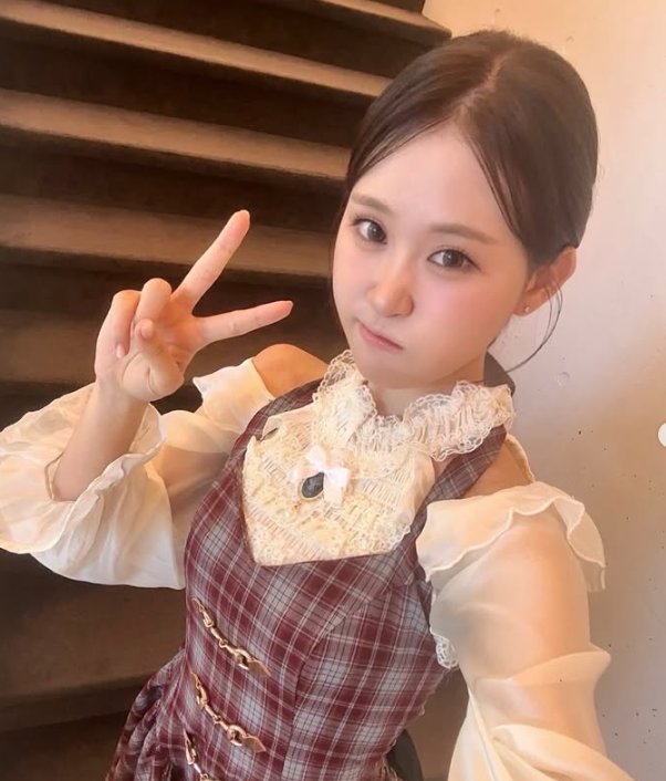 김다현 보도 사진