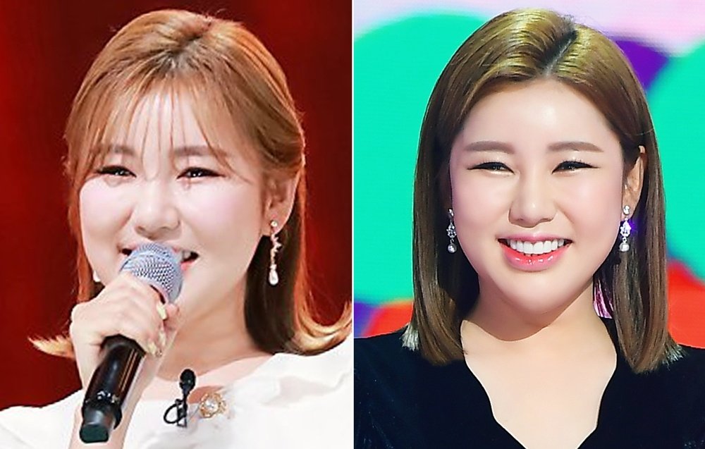 송가인 보도 사진